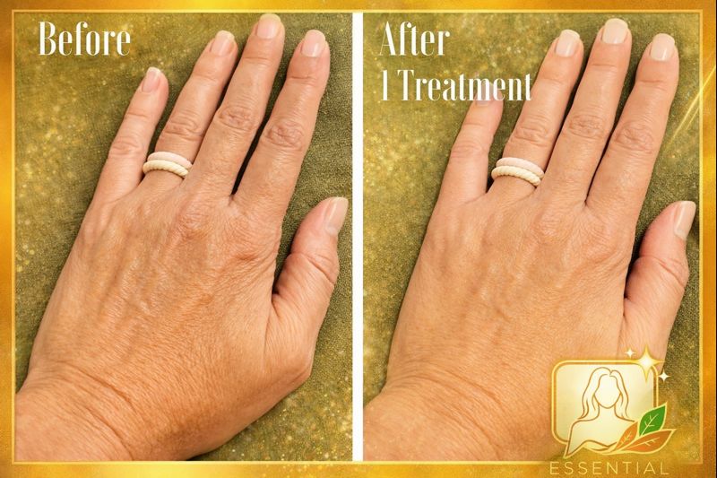 Microchanneling Skin Tightening Results