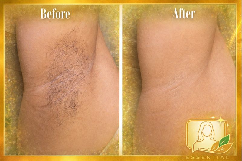 Sugaring Underarms Results