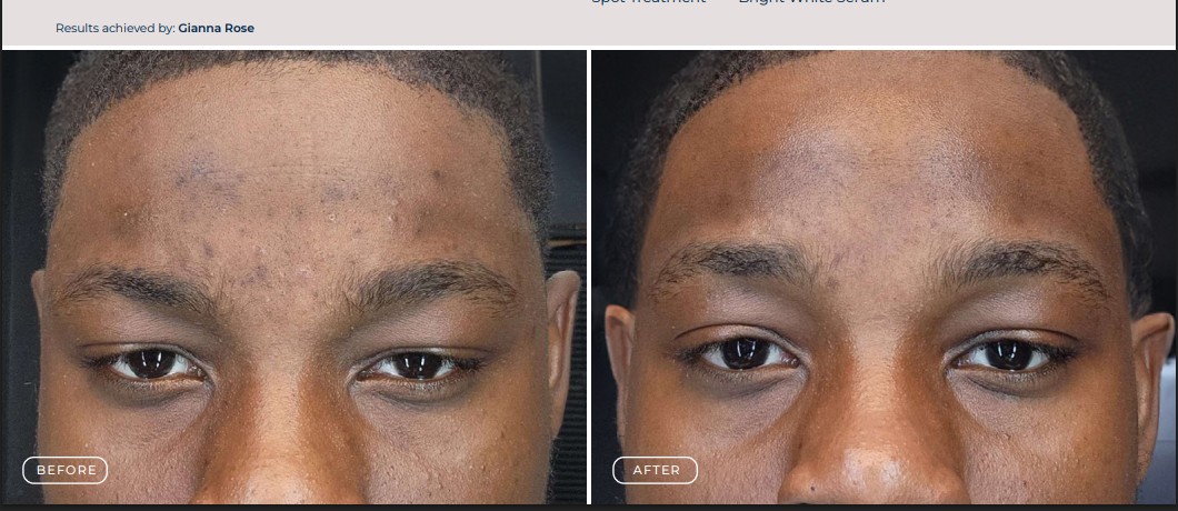 Circadia Brightening Results